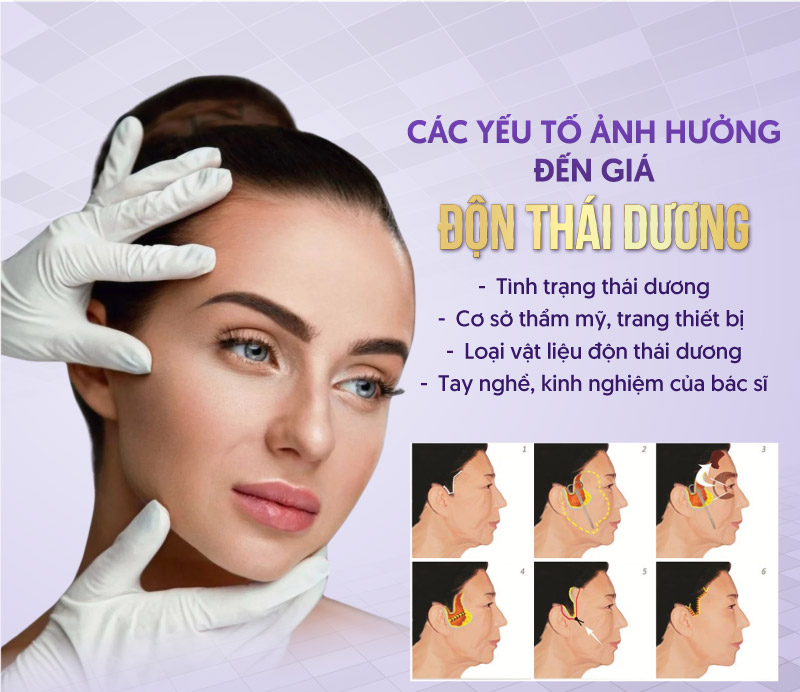 giá độn thái dương giá độn thái dương