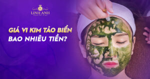giá vi kim tảo biển