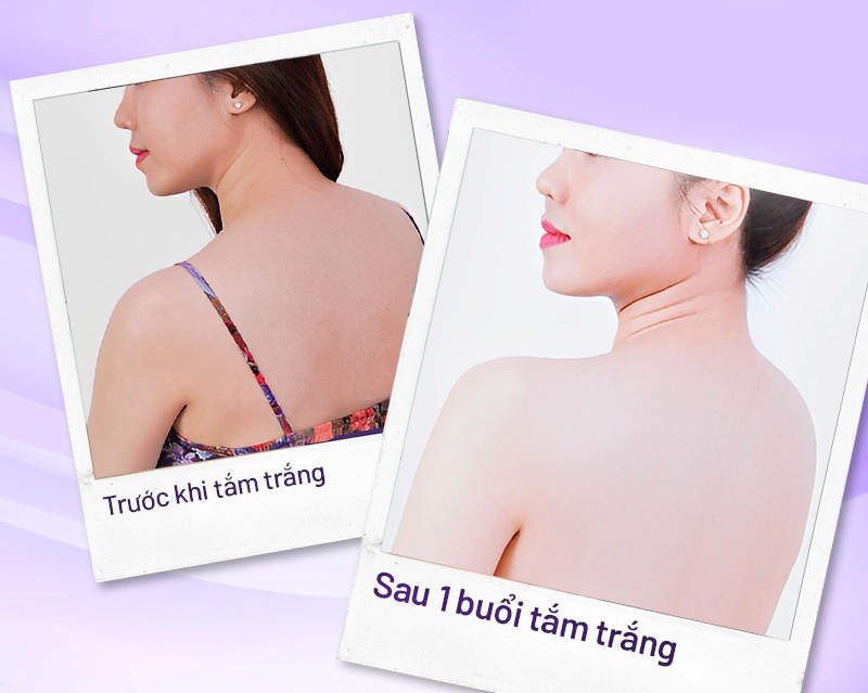 tắm trắng glubel giá bao nhiêu