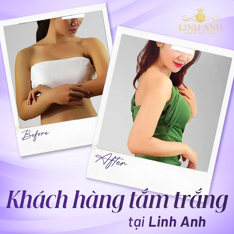 tắm trắng hiệu quả