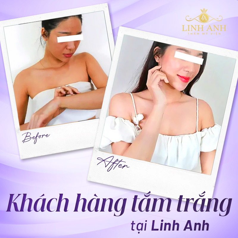 tắm trắng toàn thân