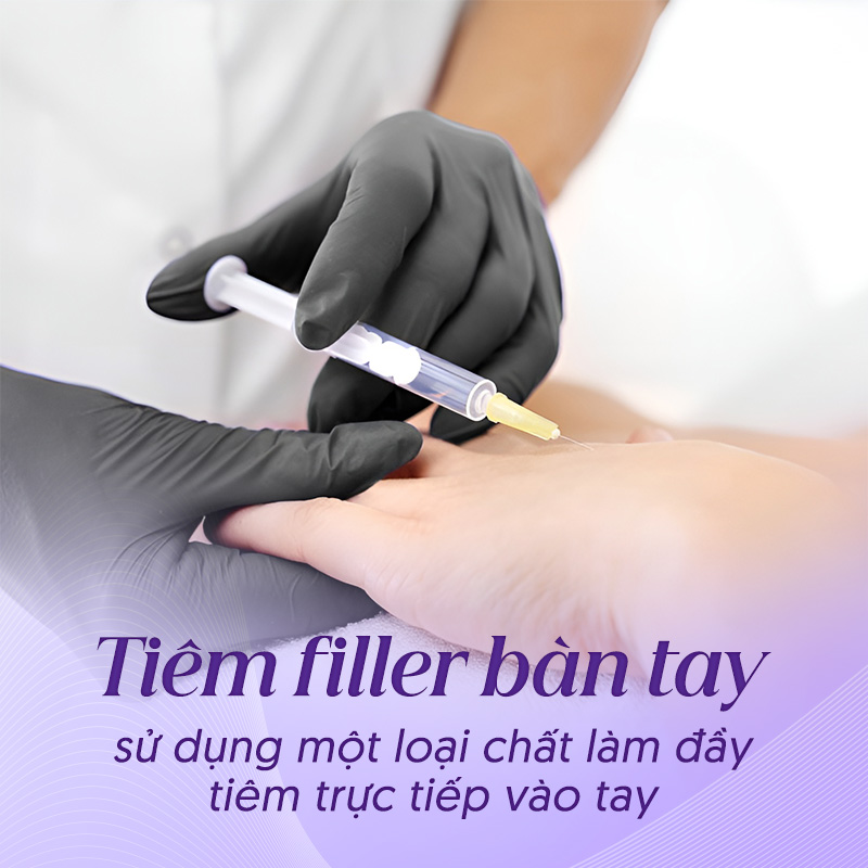 tiêm filler ngón tay giá bao Nhiêu