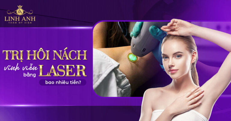 Trị hôi nách bằng laser bao nhiêu tiền? Chi phí mới nhất