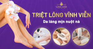 triệt lông vĩnh viễn