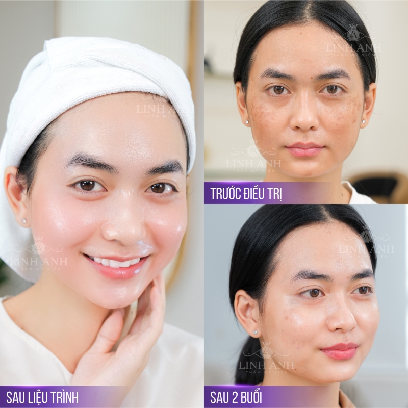 vi kim tao bien tai Linh Anh