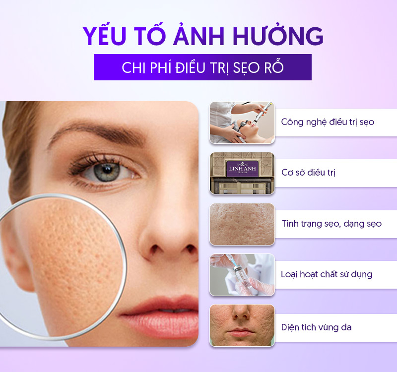 yếu tố ảnh hưởng đến chi phí trị sẹo rỗ