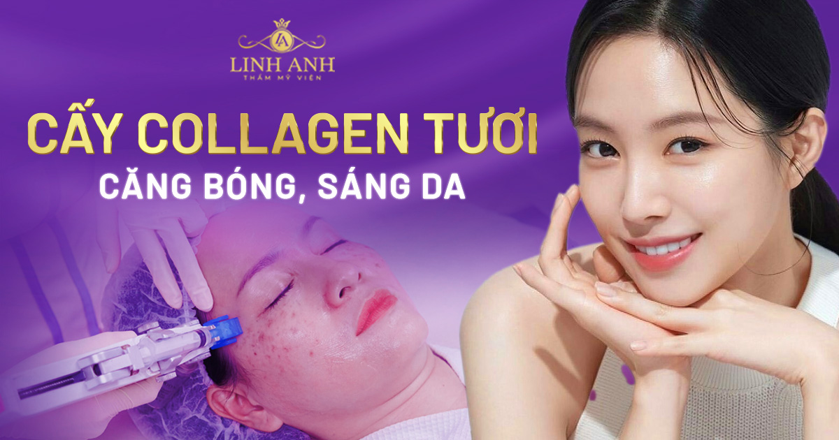 Cấy collagen tươi – Liệu pháp giúp căng bóng, sáng da hiệu quả