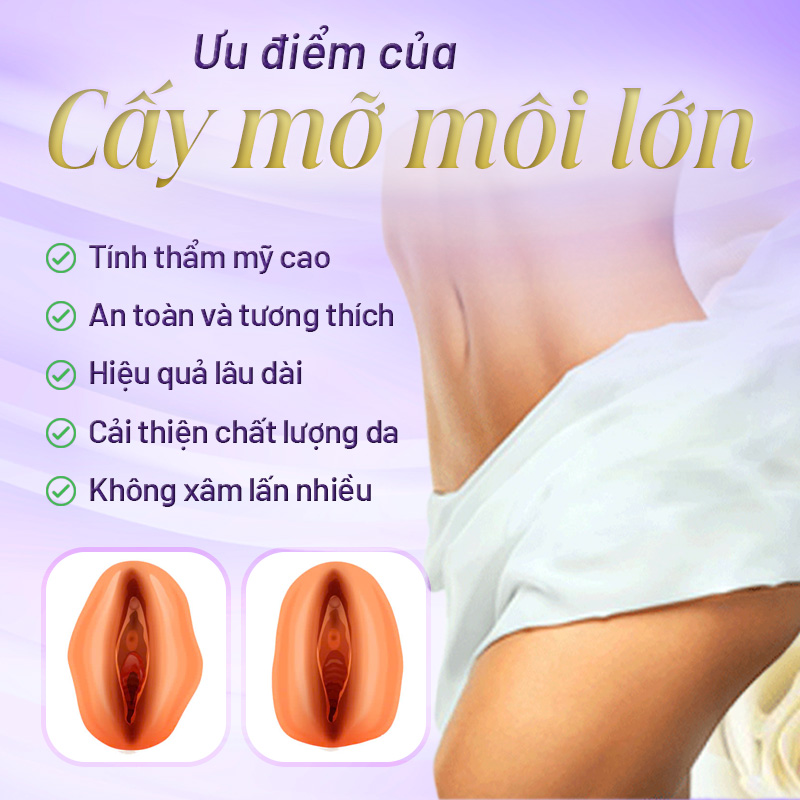 cấy mỡ môi lớn là gì