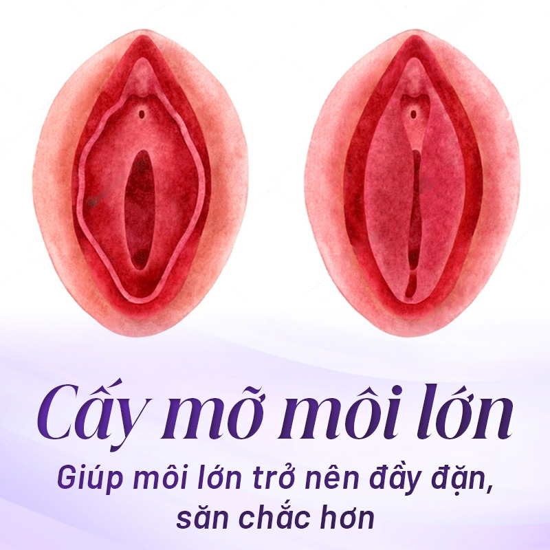 cấy mỡ môi lớn vùng kín