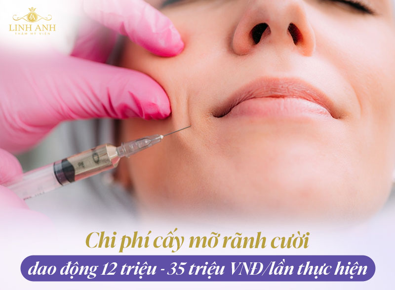 Cấy mỡ rãnh cười giá bao nhiêu