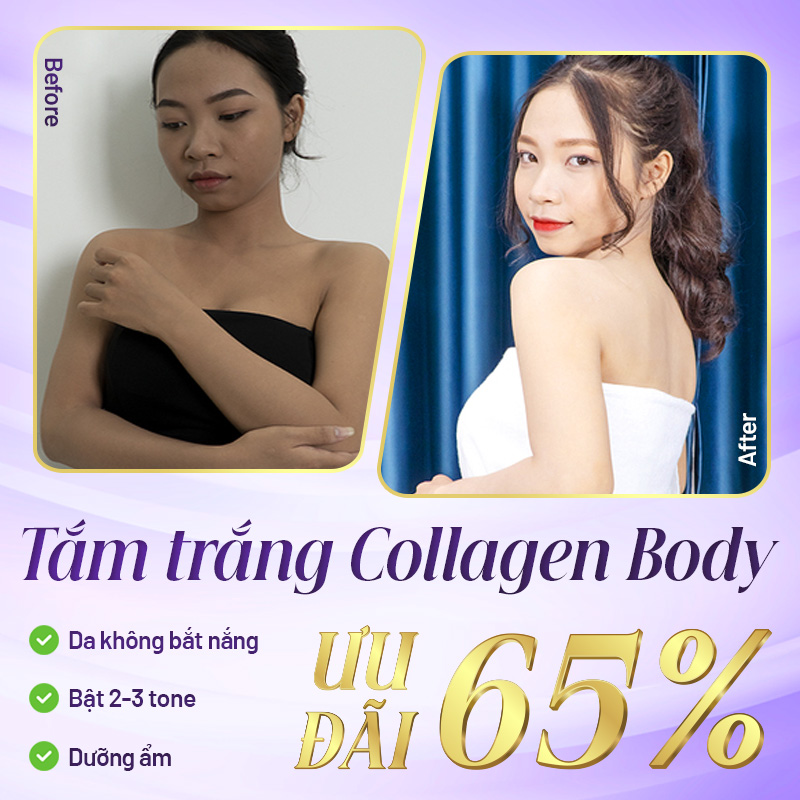 chi phí tắm trắng collagen body
