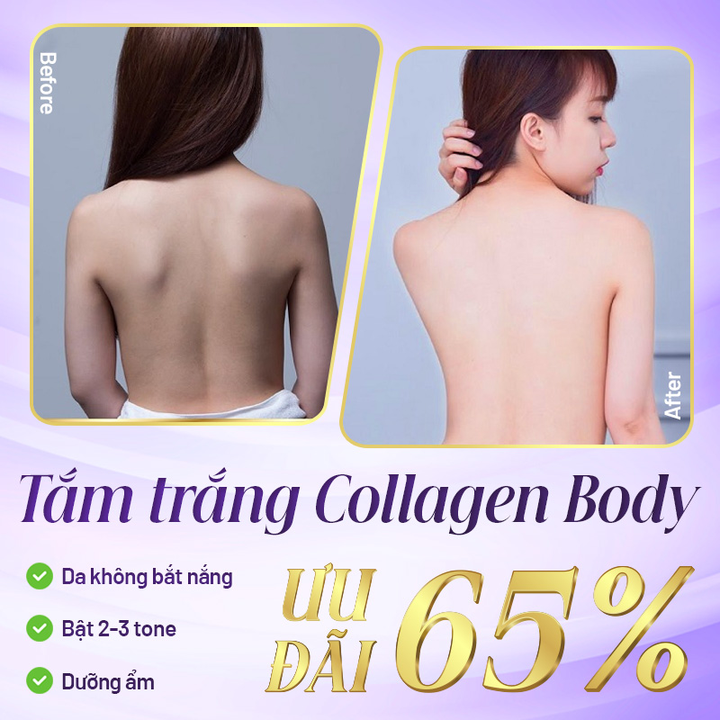 tắm trắng collagen body ở đâu