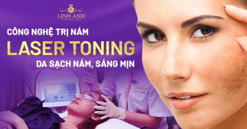 trị nám Laser Toning