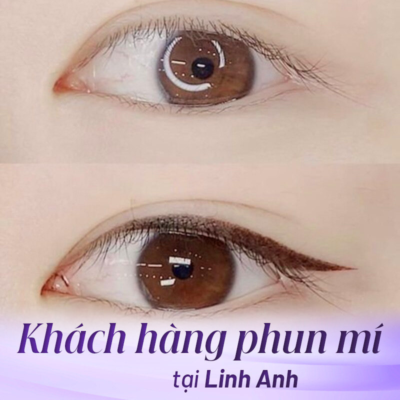 xăm mí mắt tại Linh Anh