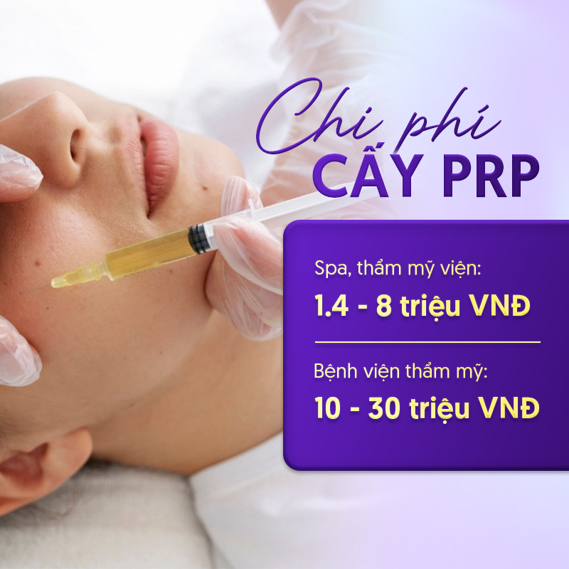 cấy prp tại Linh Anh giá bao nhiêu