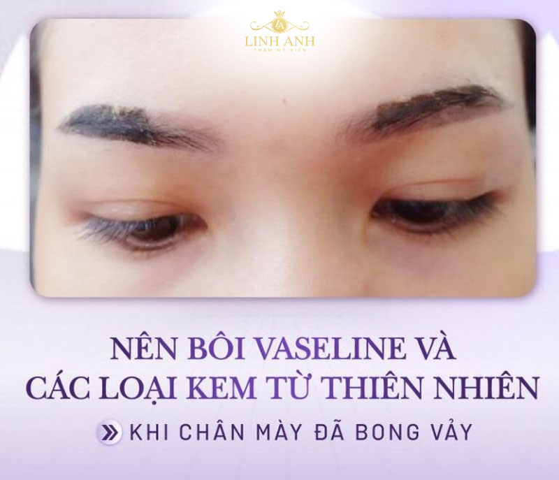 chăm sóc sau điêu khắc mày chăm sóc sau điêu khắc mày