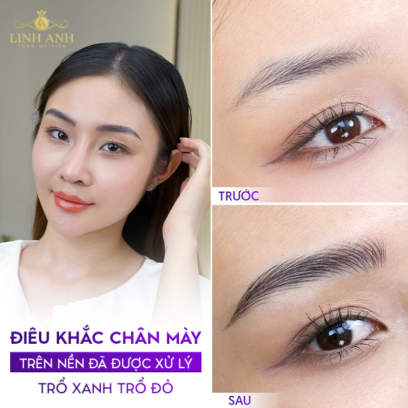 chân mày bị trổ đỏ chân mày bị trổ đỏ