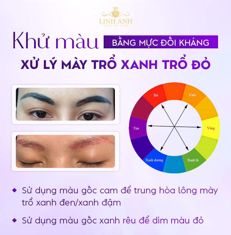 chân mày bị trổ xanh chân mày bị trổ xanh