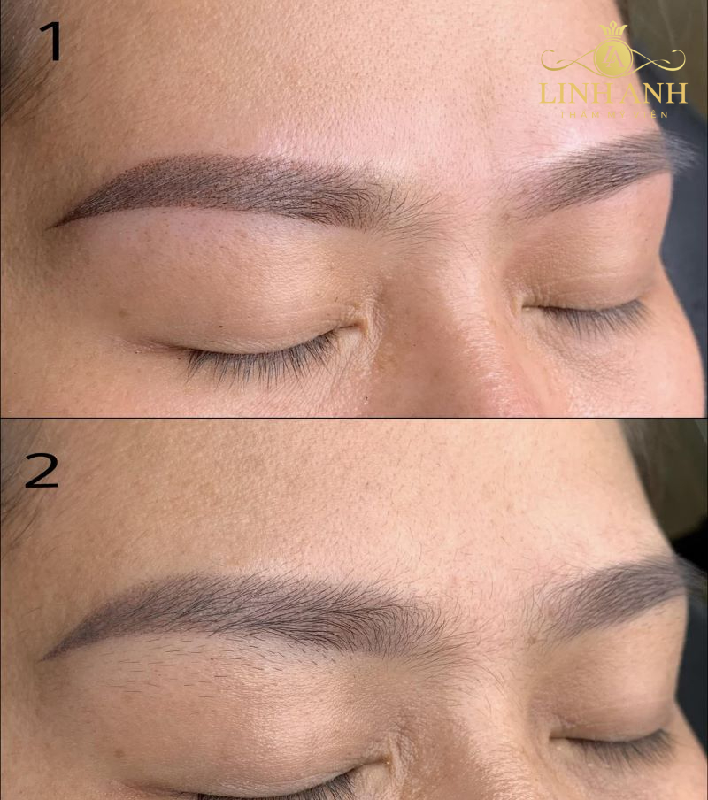 hình ảnh lông mày đang bong thực tế hình ảnh lông mày đang bong thực tế