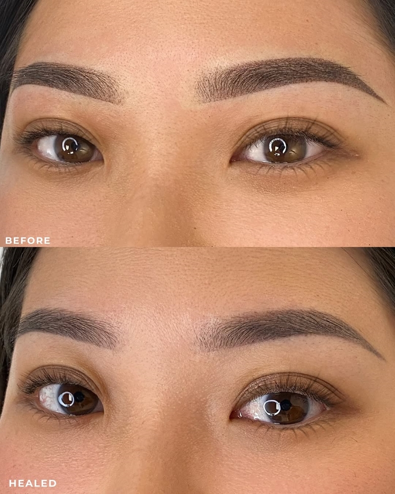 hình ảnh lông mày trước và sau khi bong hình ảnh lông mày trước và sau khi bong