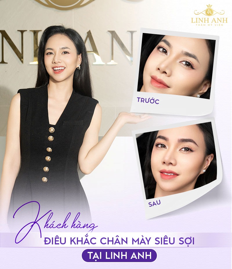 Làm chân mày đẹp ở tphcm