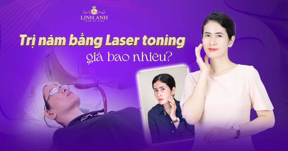 laser toning giá bao nhiêu