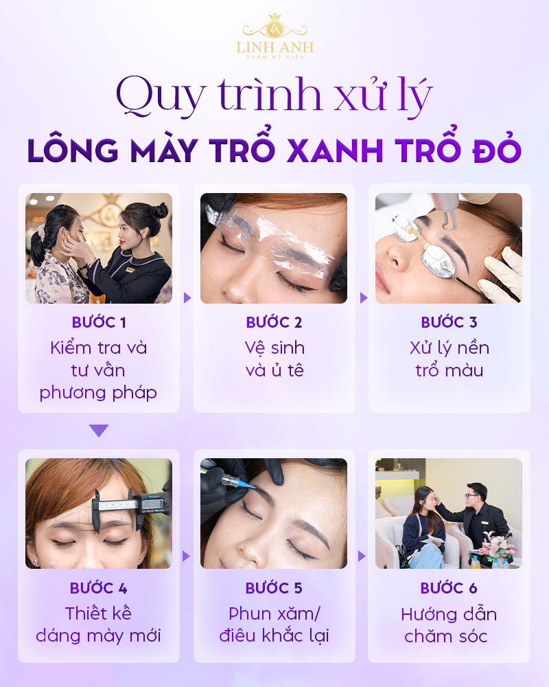 lông mày trổ xanh xử lý màu gì lông mày trổ xanh xử lý màu gì