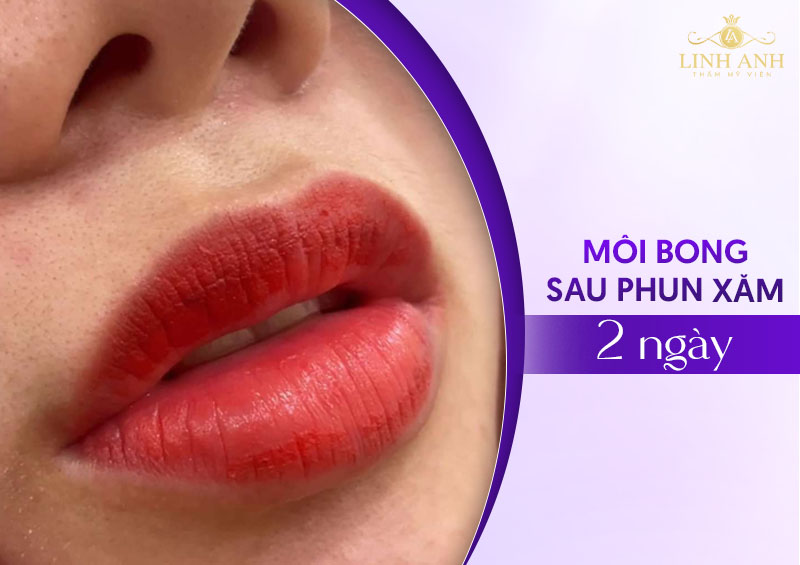 môi bong sau 2 ngày có bị hỏng không