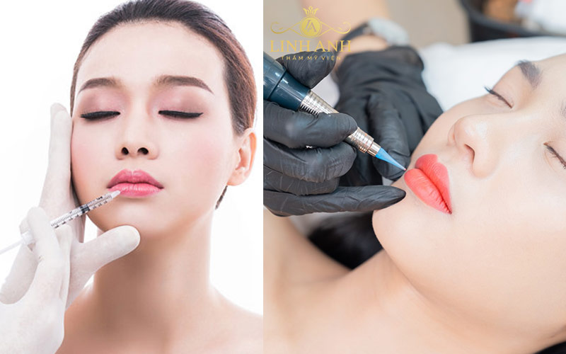 Môi sau khi phun xong vẫn có thể tiêm filler được Môi sau khi phun xong vẫn có thể tiêm filler được