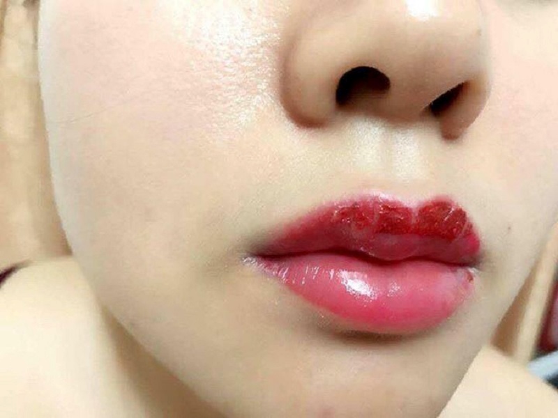 nen ve sinh moi bang nuoc am hoac nuoc muoi