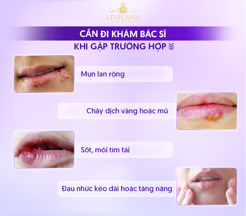 nổi mụn nước ở môi sau khi xăm có gây sẹo không nổi mụn nước ở môi sau khi xăm có gây sẹo không