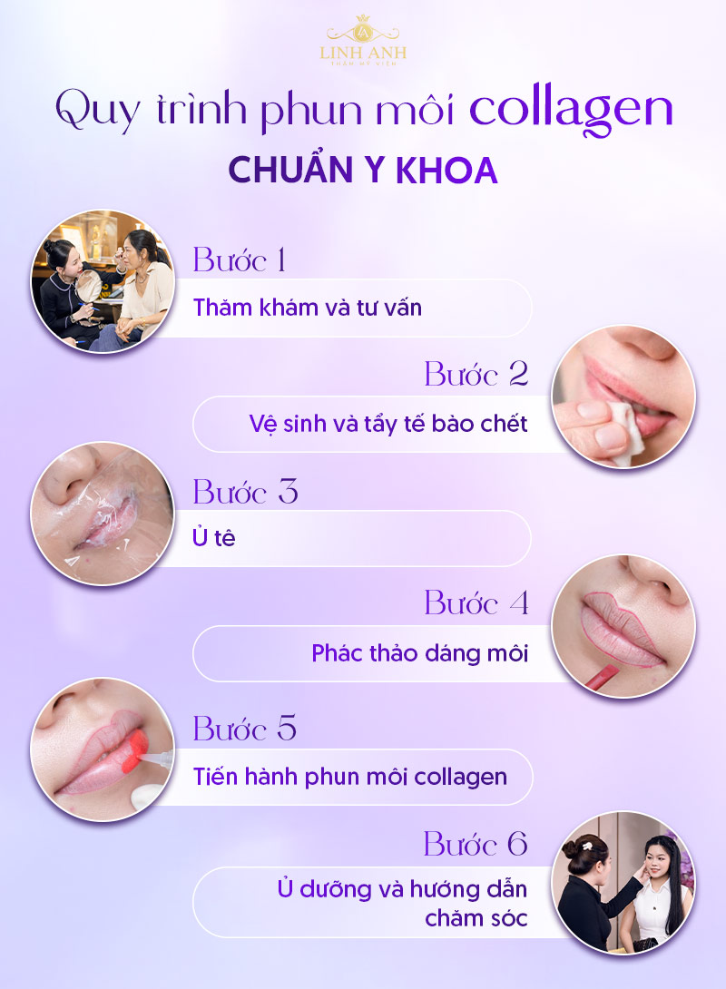 phun môi collagen linh anh phun môi collagen linh anh