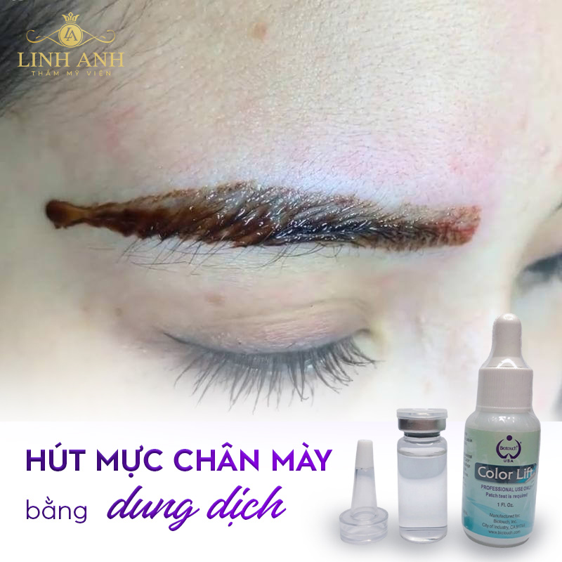 tại sao lông mày trổ đỏ tại sao lông mày trổ đỏ