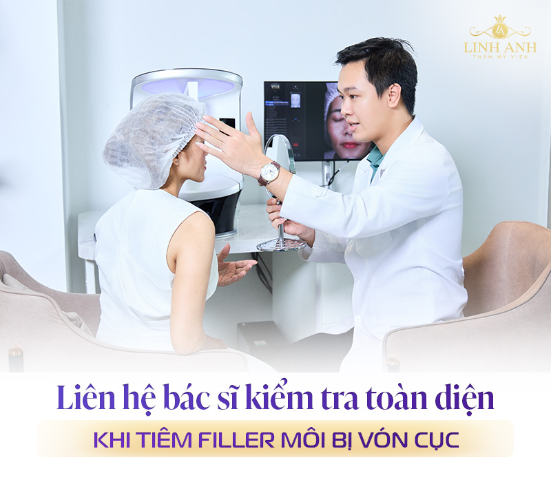 Tiêm filler môi bị vón cục phải làm sao