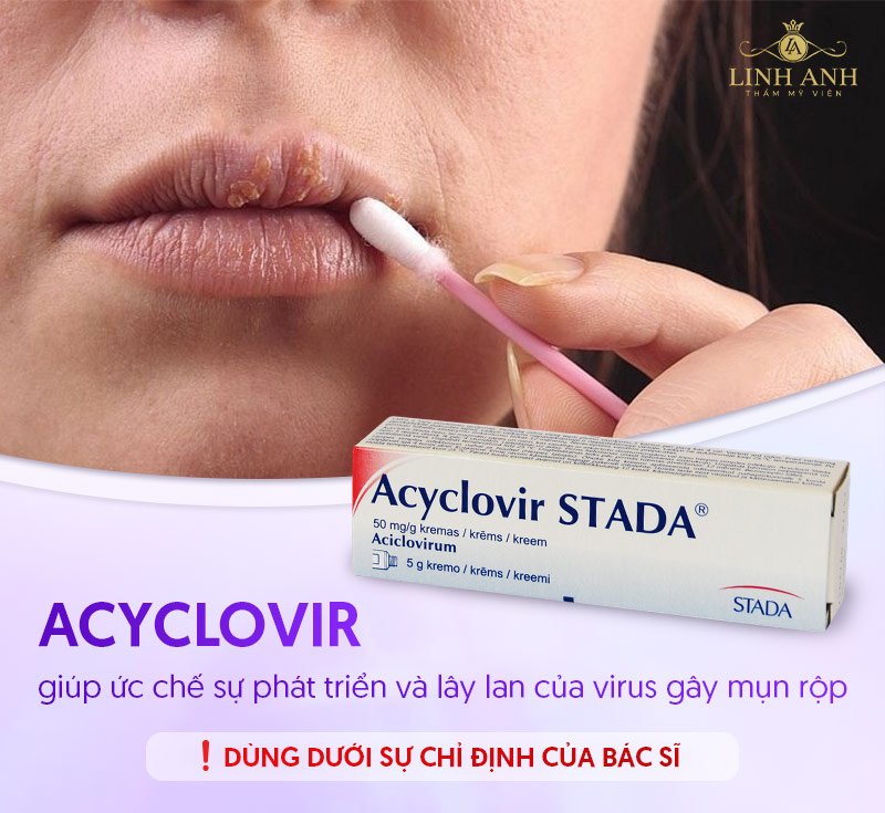 xăm môi bị mụn nước bôi thuốc Acyclovir xăm môi bị mụn nước bôi thuốc Acyclovir