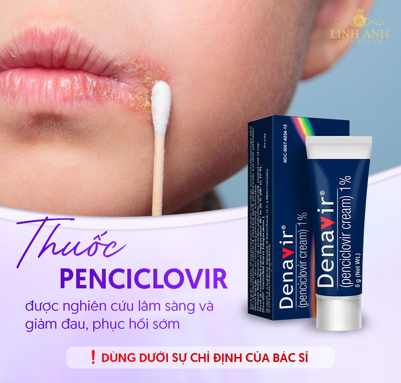 xăm môi bị mụn nước bôi thuốc Penciclovir xăm môi bị mụn nước bôi thuốc Penciclovir