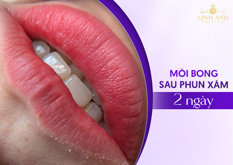 xăm môi bong sau 2 ngày