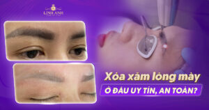 địa chỉ xóa xăm chân mày uy tín ở tphcm