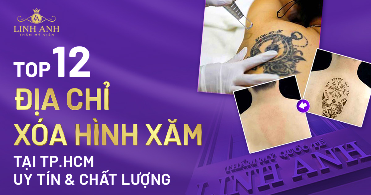 địa chỉ xoá xăm uy tín