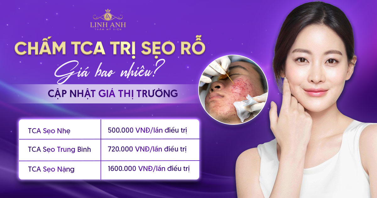Chấm TCA trị sẹo rỗ giá bao nhiêu? Ưu và nhược điểm của chấm TCA