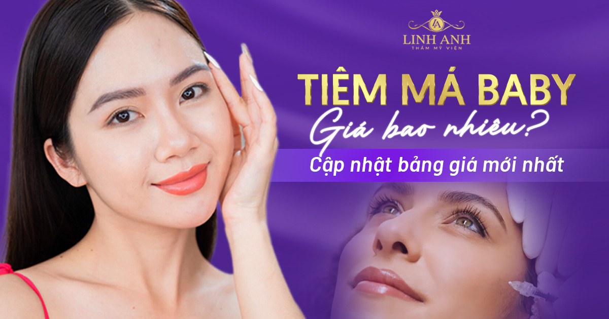 Tiêm Filler má baby bao nhiêu tiền? Bảng giá cập nhật mới nhất