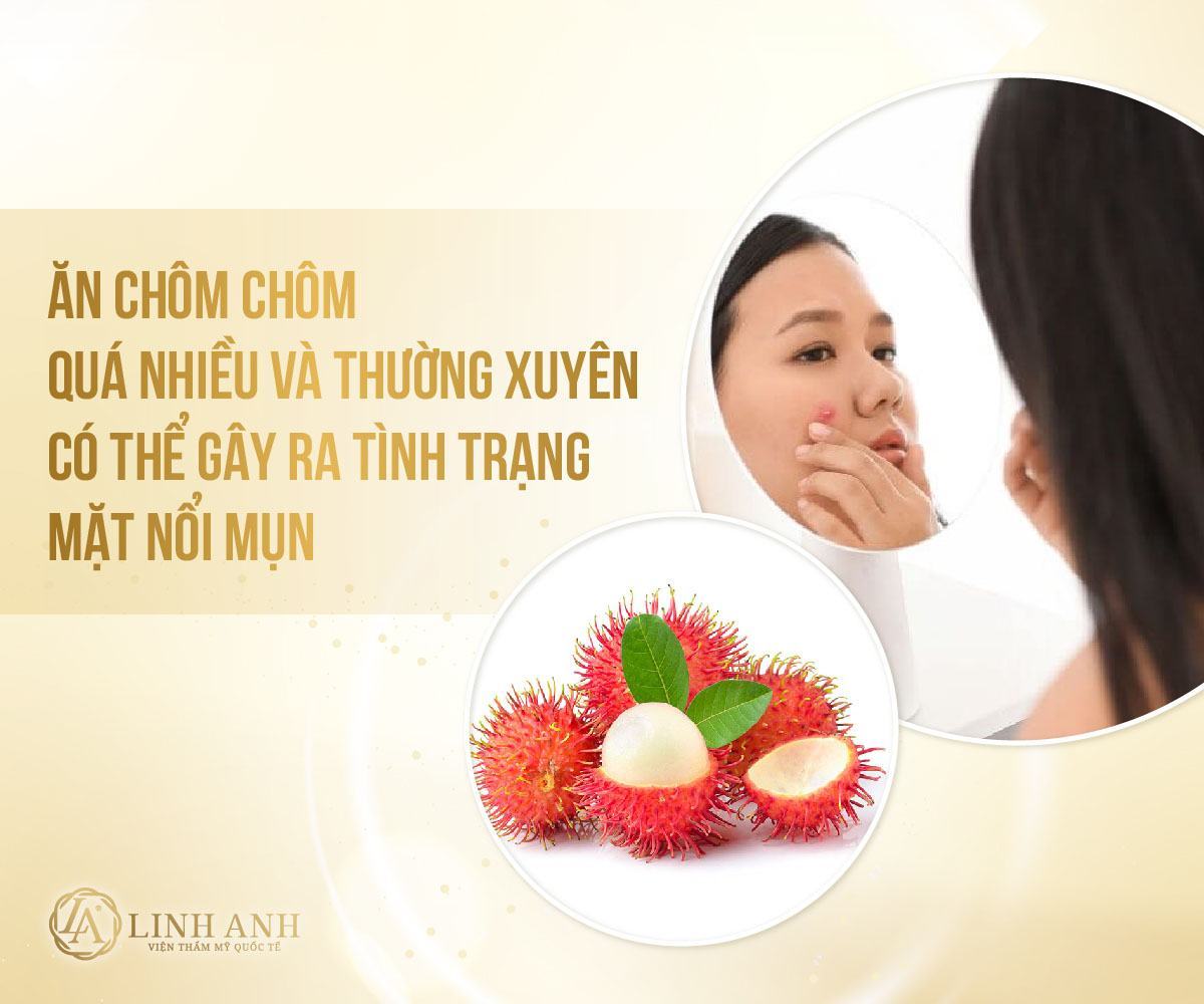 ăn chôm chôm nổi mụn không ăn chôm chôm có nổi mụn hay không - Viện thẩm mỹ quốc tế Linh Anh