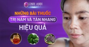 bài thuốc dân gian trị nám tàn nhang