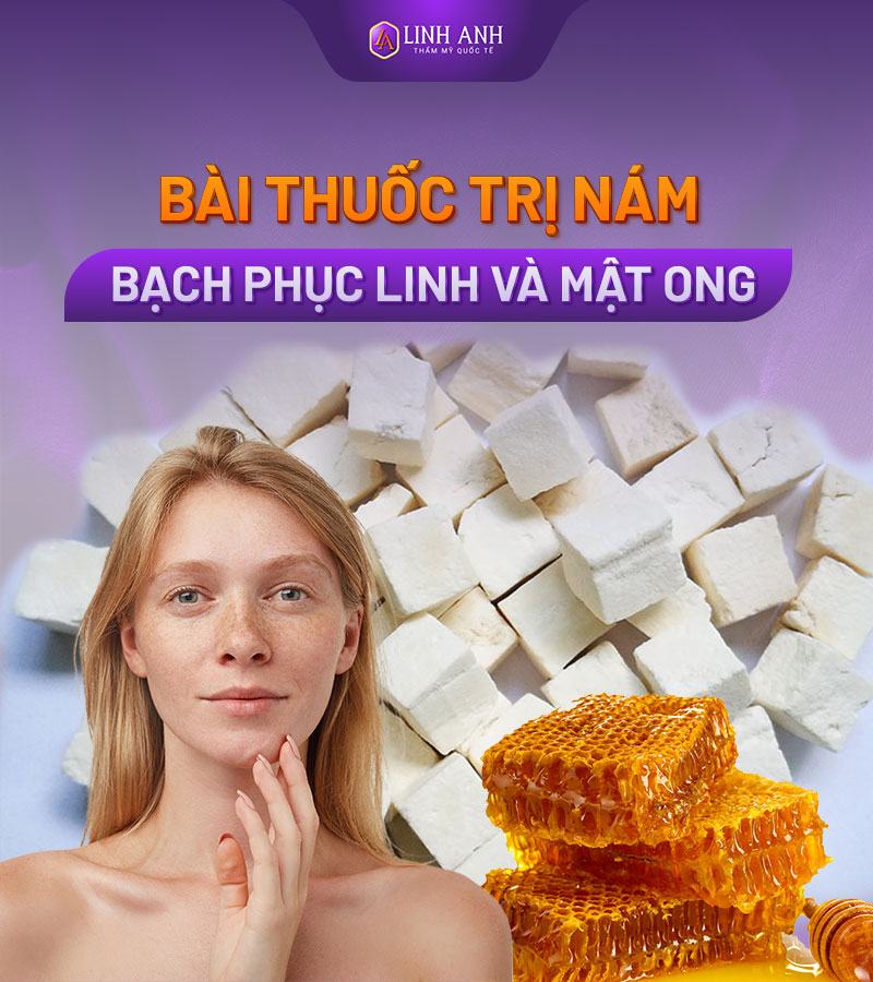 bài thuốc dân gian trị nám tàn nhang bài thuốc dân gian trị nám tàn nhang hiệu quả