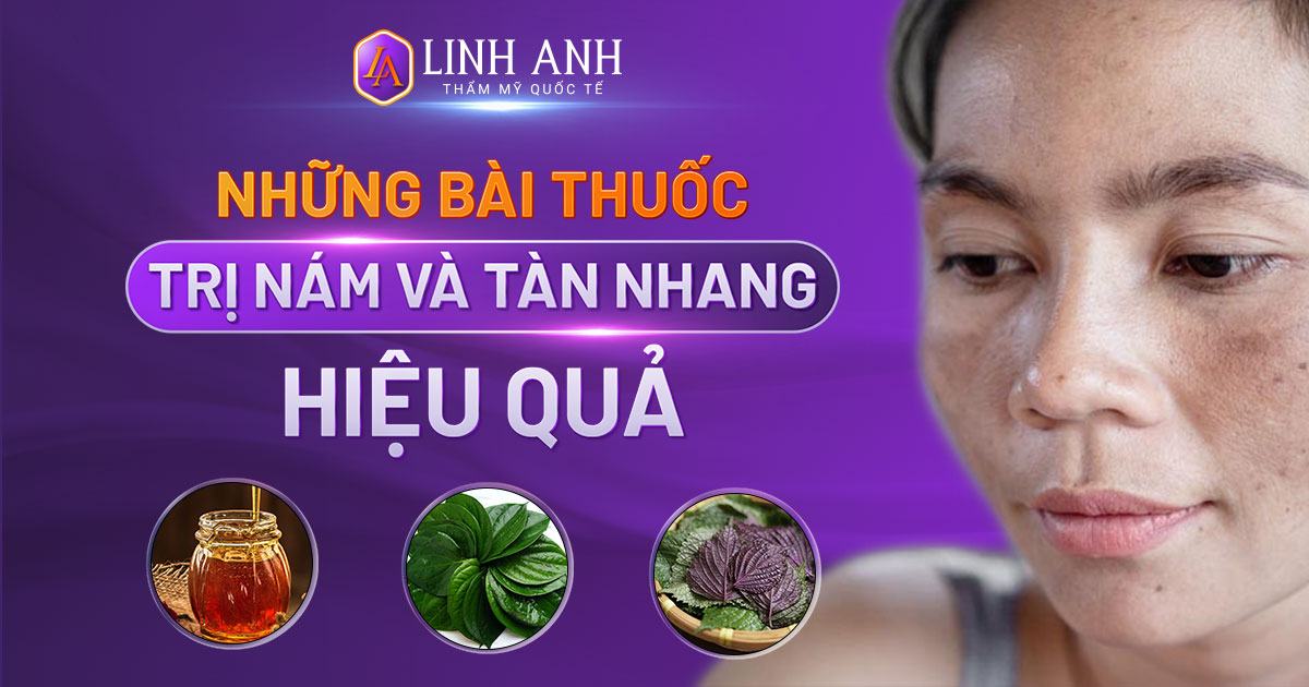 Những bài thuốc dân gian trị nám tàn nhang hiệu quả