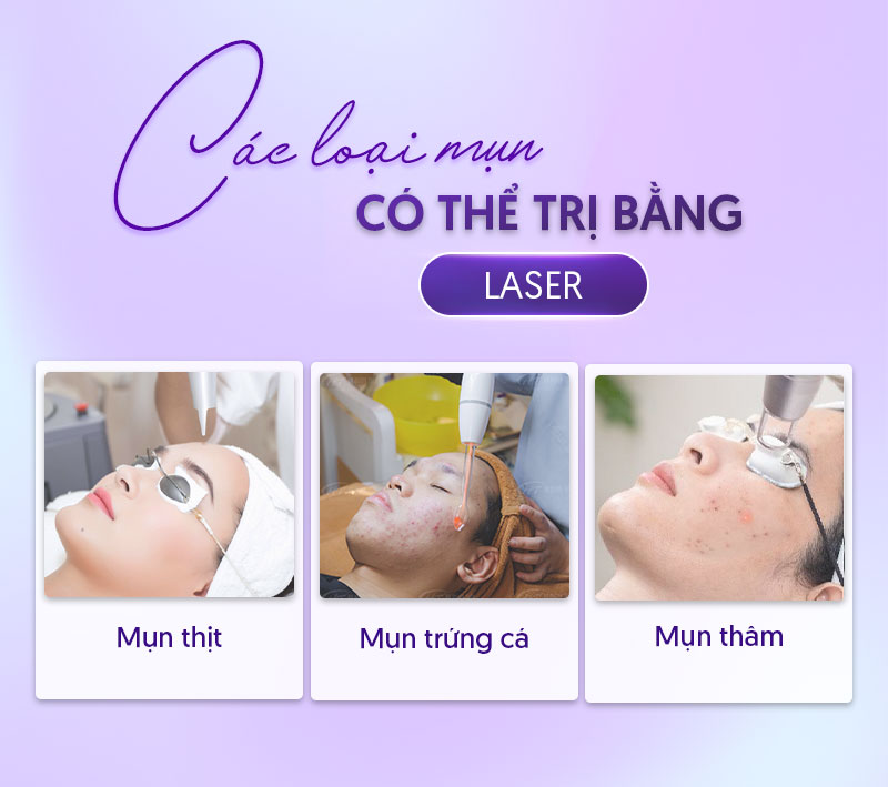 bắn laser trị mụn bao nhiêu tiền bắn laser trị mụn bao nhiêu tiền