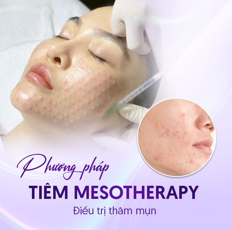 bảng giá điều trị thâm mụn bảng giá điều trị thâm mụn