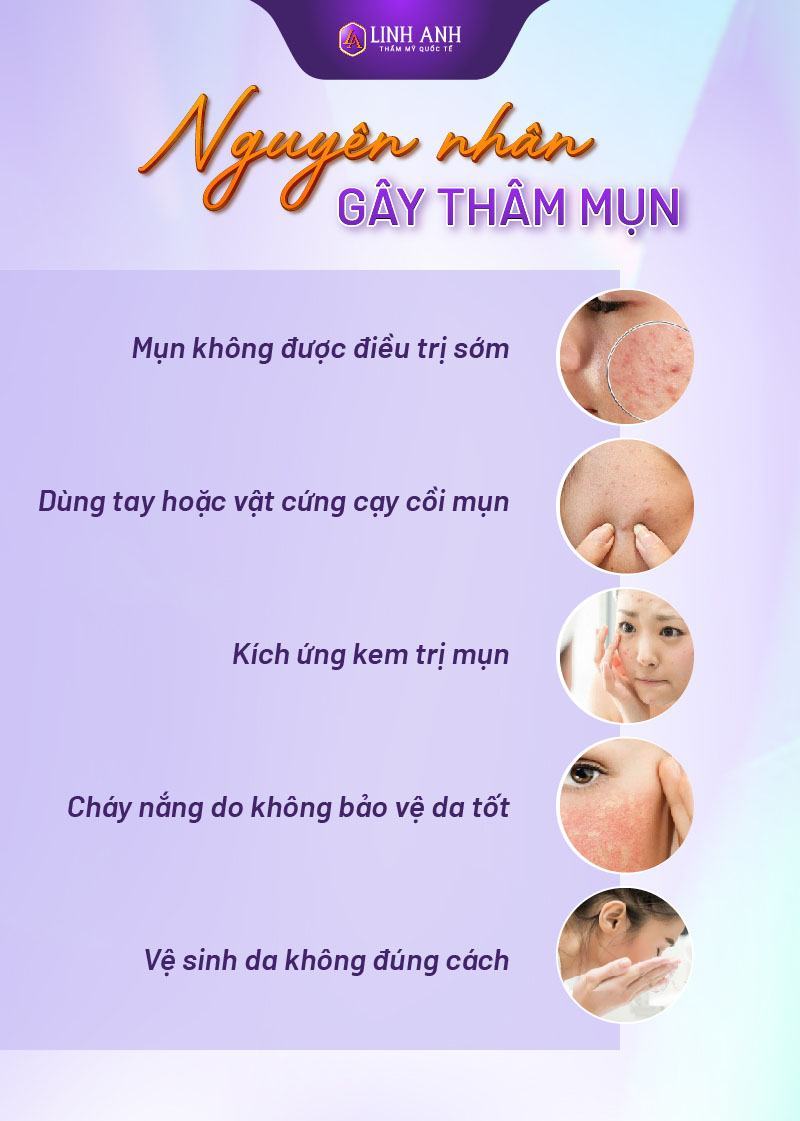 vết thâm mụn bao lâu thì hết bao lâu thì hết thâm mụn