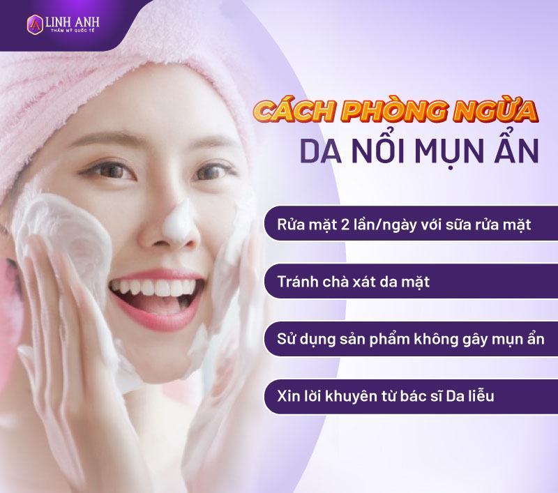 có nên đi nặn mụn ẩn không bị mụn ẩn có nên nặn không