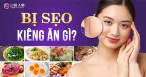 bị sẹo kiêng ăn gì